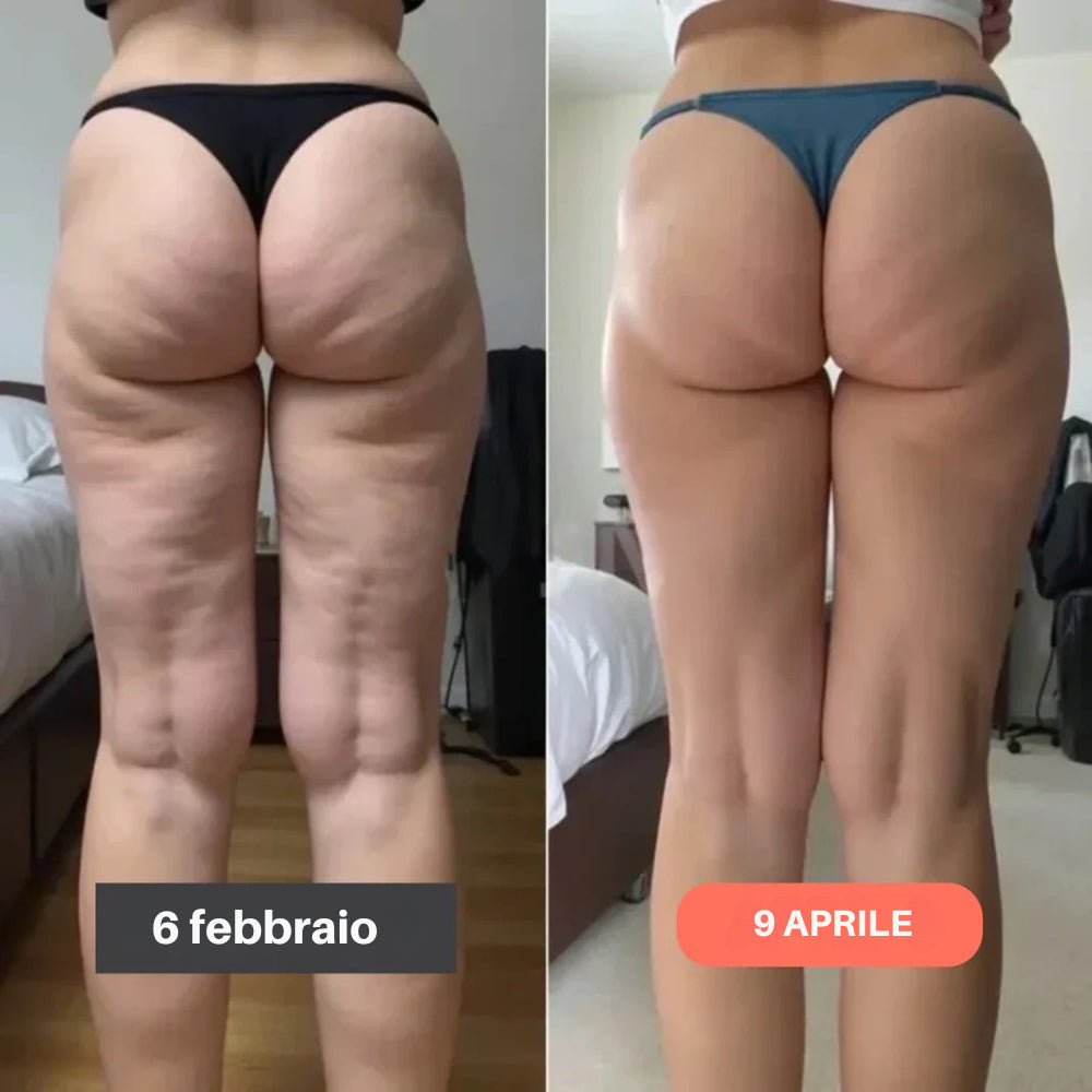 Leggings 3D Purelya – Ridefinisci la tua silhouette senza sforzo